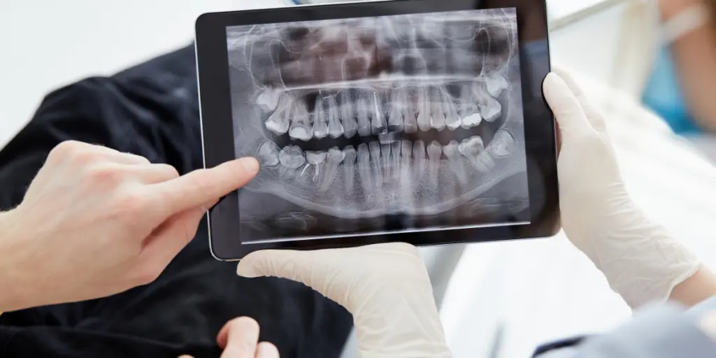Portable dental X-ray equipment used during a home visit